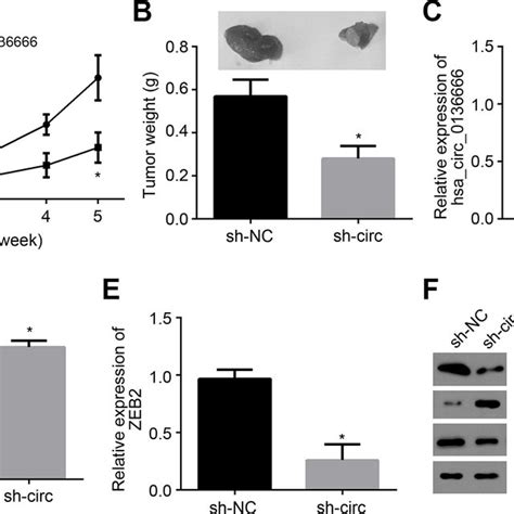 Hsa Circ Mir P Zeb Axis Contributes To Os Growth In Vivo