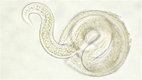 Parasitic Worms May Keep Inflammatory Bowel Disease at Bay | Mental Floss