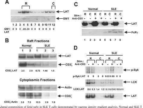 Figure From Alterations In Lipid Raft Composition And Dynamics