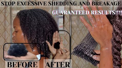 Stop Excessive Hair Shedding And Breakage Naturally Simple Hair Habits That Work Natural