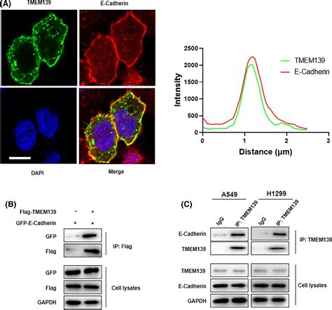 TMEM139 Prevents NSCLC Metastasis By Inhibiting Lysosomal Degradation