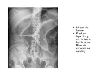 Introduction To Abdominal X Ray Interpretation Ppt