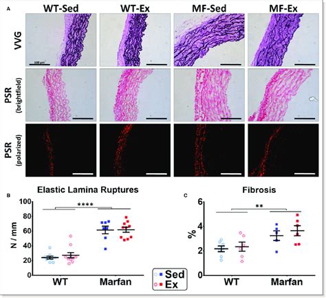 Aorta Histological Analyses In Sedentary And Trained Wt And Mf Mice A