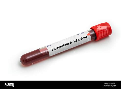 Lipoprotein A LPa Test Medical Check Up Test Tube With Biological