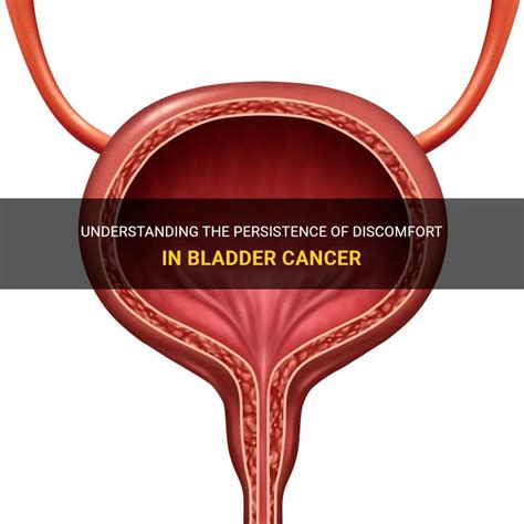 Understanding The Persistence Of Discomfort In Bladder Cancer Medshun