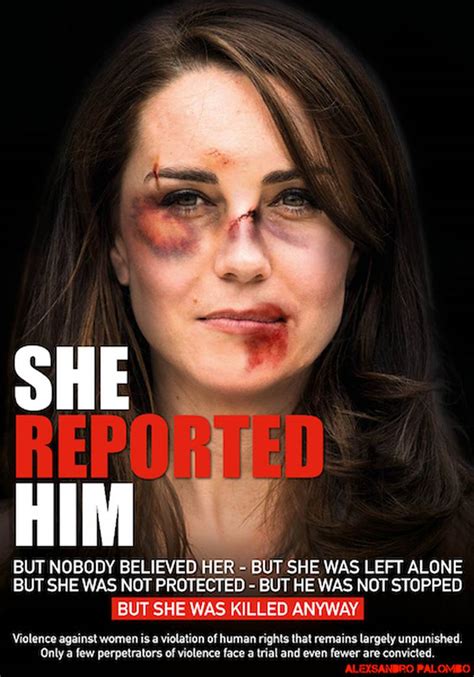 Doctored Photos Showing Kate Middleton With Bruised Face Published