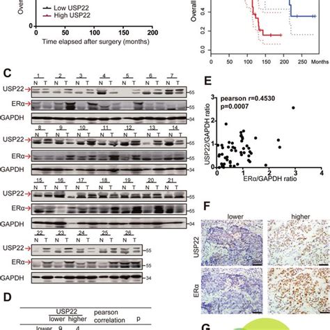 USP22 Is Highly Expressed In Breast Cancer Tissues And Expression Of