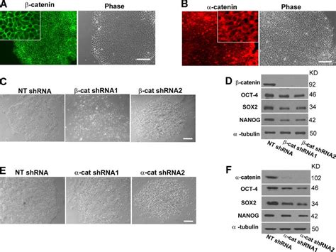 The Effects Of Depleting α And β Catenin On Colony Formation And Download Scientific Diagram