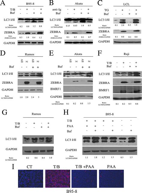 Epstein Barr Virus Blocks The Autophagic Flux And Appropriates The