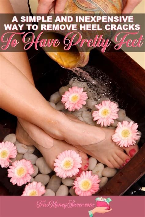 How To Remove The Dead Skin Cells On Your Feet In 2020 Dead Skin On