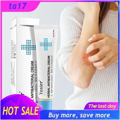 Skin Rash Cream 20g Inhibition Of Bacteria And Fungi Treatment Of