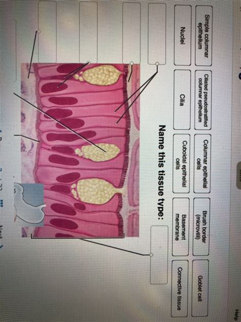 Correctly Identify This Tissue Type Practice