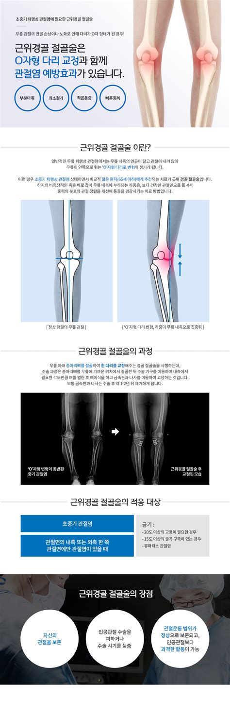 관절·척추·골절수술 연세한강병원 줄기세포·인공관절 근위경골 절골술