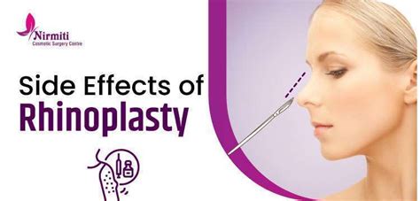 Side effects of rhinoplasty