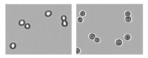 Improve Cell Counting Accuracy | Technical Note 191