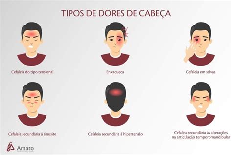 Cabeça Dolorida O Que Pode Ser - Dor de cabeça e cefaléia: saiba como aliviar os sintomas
