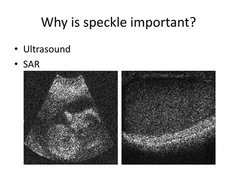 PPT - Modeling Speckle Noise in MATLAB for Imaging Applications ...