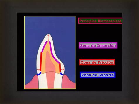 Preparaciones Dentarias Sammy Ppt Descarga Gratuita