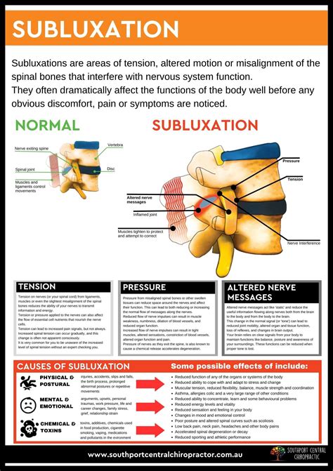 What Is A Subluxation Southport Central Chiropractic