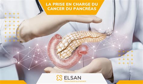 Cancer Du Foie Symptomes Diagnostic Traitements Et Espérance De Vie