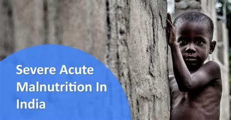 Severe Acute Malnutrition Sam