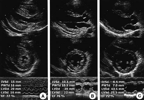 Echocardiogram Echo On Admission Showing Mild Hypokinesis Of Left Download Scientific Diagram