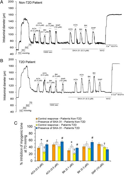 KCa Channel Activation Normalizes Endothelial Function In Type 2