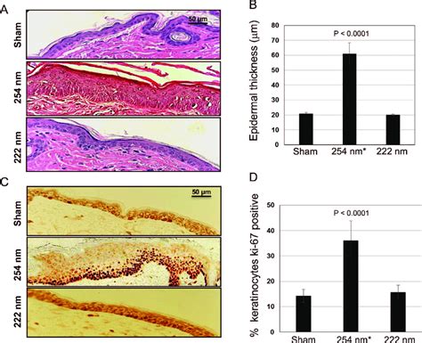 Epidermal Thickness And Keratinocyte Proliferation In Mouse Skin