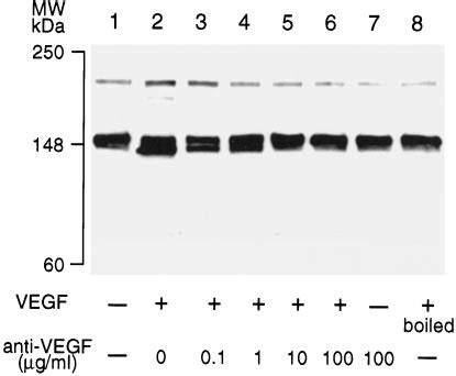 Neutralization Of VEGF Blocks KDR Up Regulation 200 PM VEGF Was