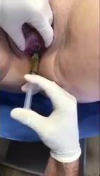 Injection In Pussy Video ThisVid