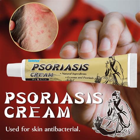 Pomada Para Psoríase Na Pele - Creme De Cuidados Com A Pele Psoríase China Pomada Dermatite Eczema ...
