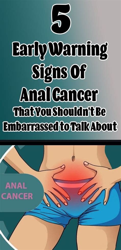 5 Early Warning Signs Of Anal Cancer That You Shouldnt Be Embarrassed