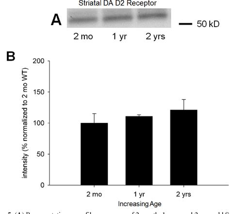 Figure From Differential Aging Related Changes Of D D And D