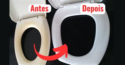 Como Clarear A Tampa Do Vaso Sanit Rio Amarelada Dicas Infal Veis