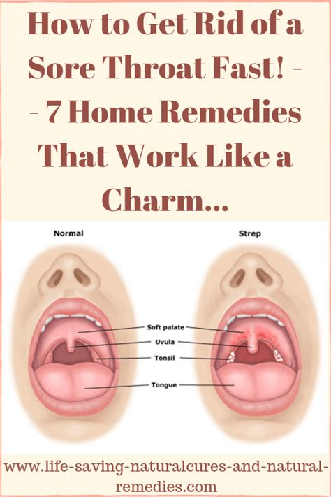 How To Get Rid Of Soar Throat Fast Phaseisland17