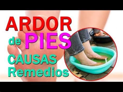 Calma El Ardor En Los Pies Con 6 Remedios Caseros YouTube Planta De