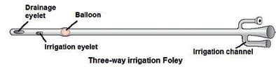 Three Way Catheter With Irrigation Channel Source Essential Clinical