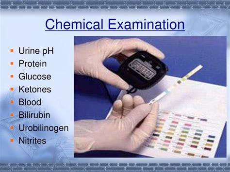 PPT Urinalysis PowerPoint Presentation ID 5498707