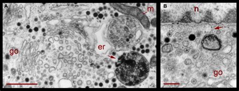 Perinuclear Multivesicular Bodies A Multivesicular Bodies Mvb