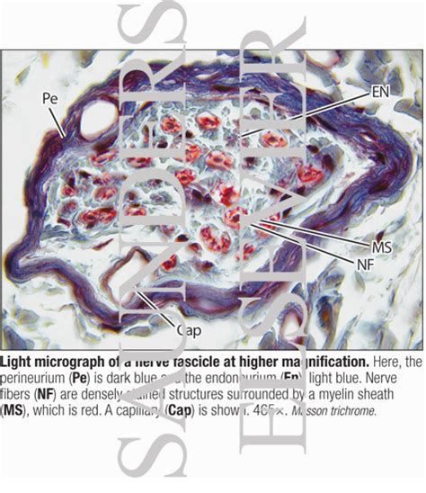 Light Micrograph of a Nerve Fascicle at Higher Magnification