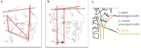 A Skeletal Angular Measurements B Skeletal Linear Measurements Download Scientific