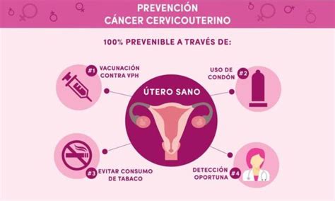 Cáncer Cervicouterino Grupo Oncológico Avanzado