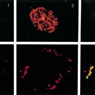 Immunohistochemical Localization Of G Protein Subunit In Pancreata