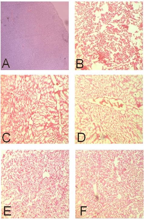 Photomicrographs Of Liver Sections Stained With Hematoxylin And Eosin