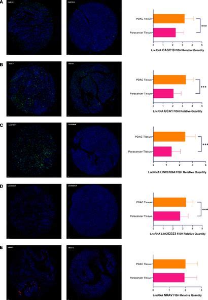 Frontiers Aerial View Of The Association Between M6a Related Lncrnas