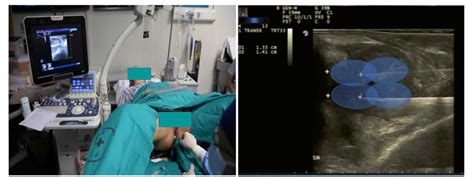 Figure 1 From The Design And Rationale Of A Multicentre Randomised Controlled Trial Comparing