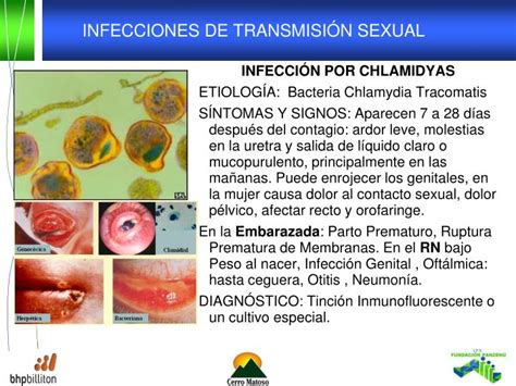 Ppt Infecciones De De Transmision Sexual Powerpoint Presentation Id6190618