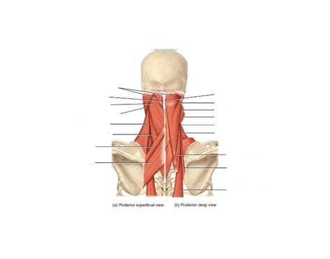 Muscles: Posterior Neck Quiz