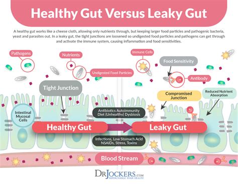 Top 10 Foods To Heal Leaky Gut Syndrome