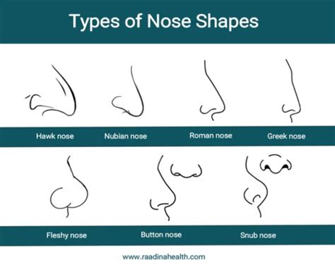 Types of Noses by Race - Raadina Health in 2024 | Nose shapes, Greek ...